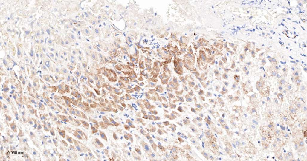 人丙酮酸脱氢酶激酶亚型2即用型免疫组化试剂盒-IHC0692H